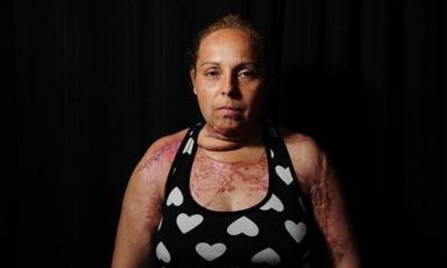 Piden 18 años de prisión para un técnico electrónico por prender fuego a su mujer