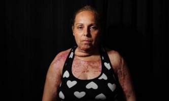 Piden 18 años de prisión para un técnico electrónico por prender fuego a su mujer